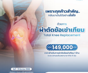 Total Knee Replacement